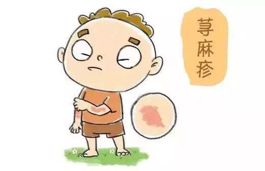 初期荨麻疹的症状特点